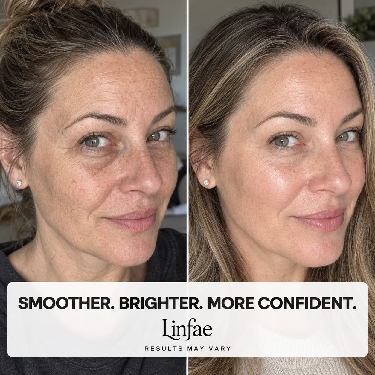 Collagen Plump & Repair Volufiline Balm