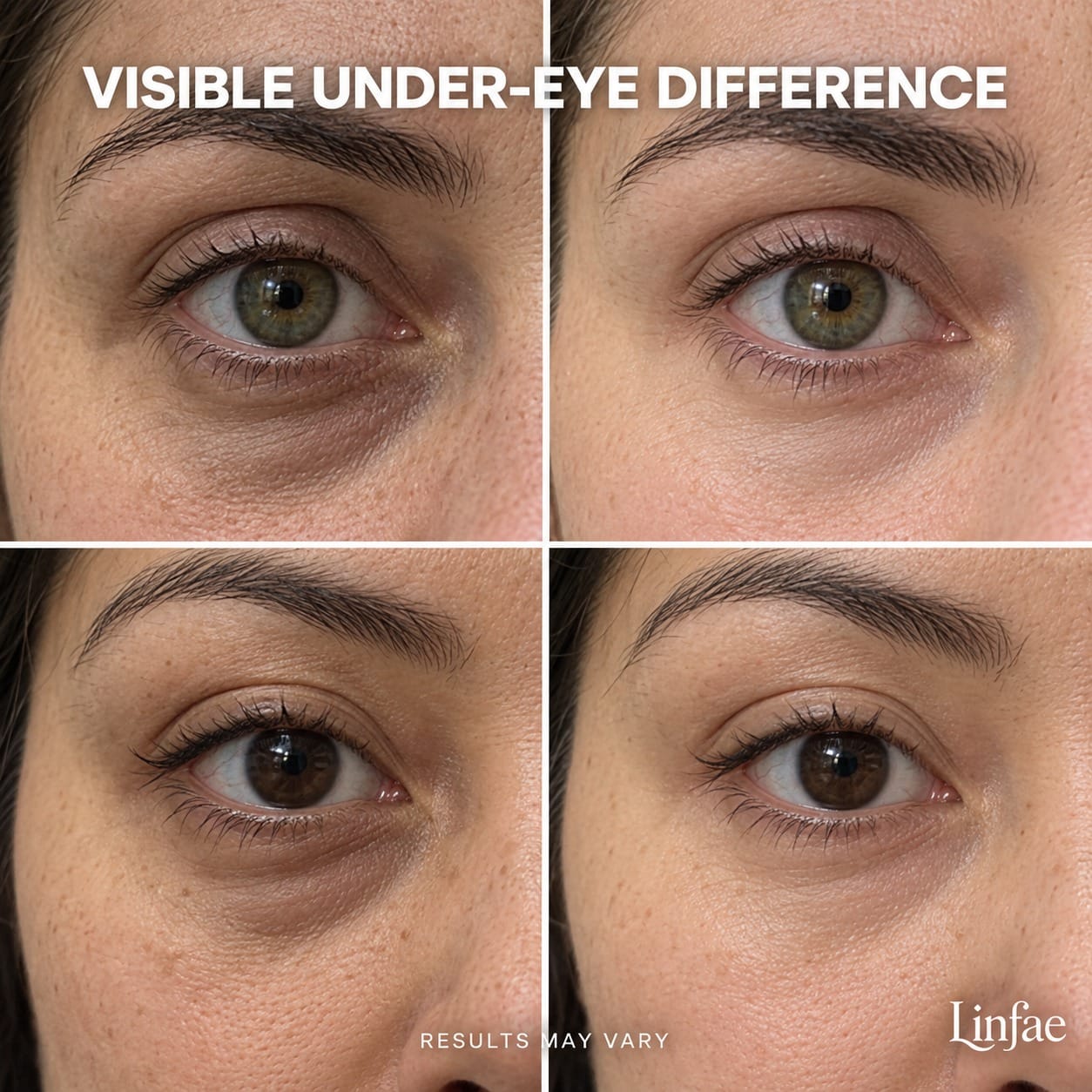 Collagen Plump & Repair Volufiline Balm